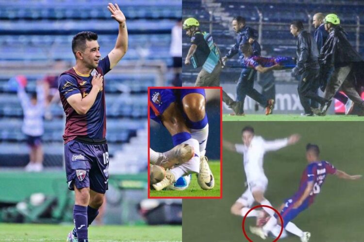 Escalofriante lesión en el fútbol mexicano (video)