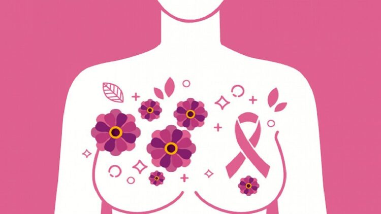 Tratamiento de radioterapia más breve para el cáncer de mama gana apoyo entre especialistas