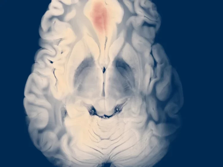 Investigadores crean nanorobots capaces de reparar aneurismas en el cerebro