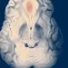 Investigadores crean nanorobots capaces de reparar aneurismas en el cerebro