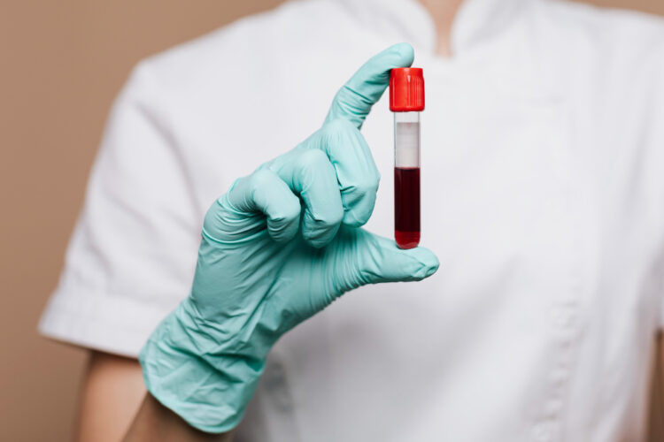 Un análisis de sangre predice el riesgo de enfermedad cardiovascular en las mujeres 30 años antes