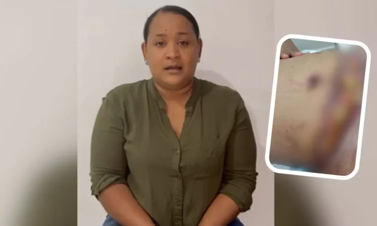 Mujer denuncia cirujano «le destrozó la vida» tras mala práctica en cirugía estética