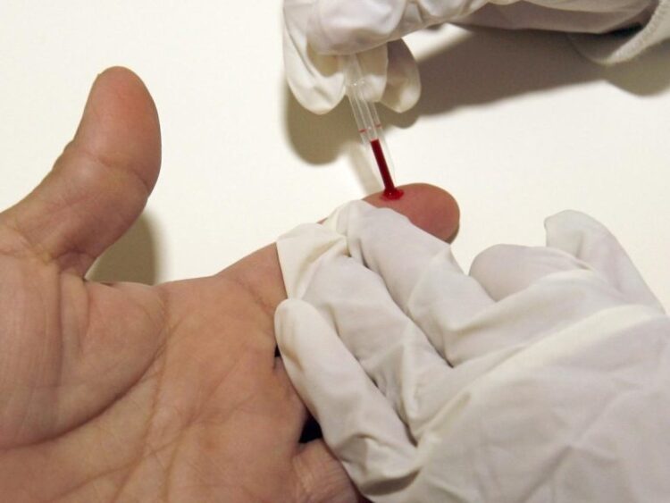 Desarrollan una inmunoterapia para revertir el daño cardíaco debido al colesterol