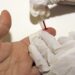 Desarrollan una inmunoterapia para revertir el daño cardíaco debido al colesterol