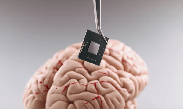 Un avance revolucionario: Implante cerebral de Neuralink cambia la vida de un veterano paralizado en Miami